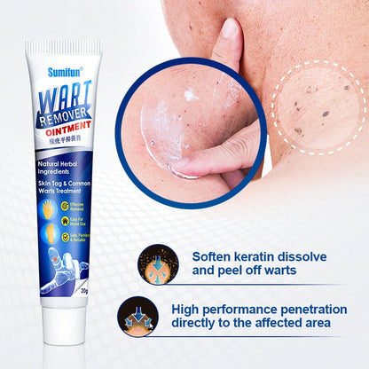 Wart Remover