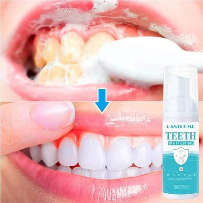 Teeth Whitening Mousse