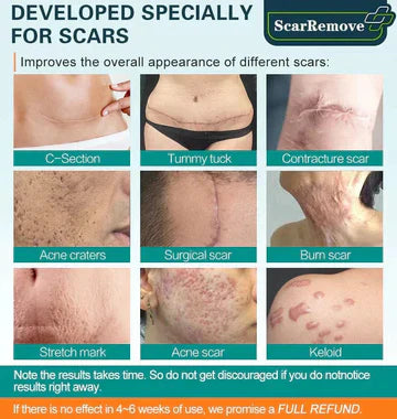 ScarRemove™ Advanced Scar Spray