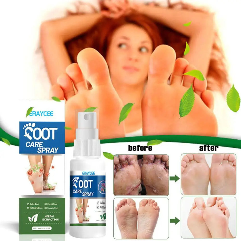 Foot Deodorant Spray