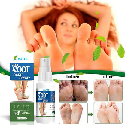 Foot Deodorant Spray