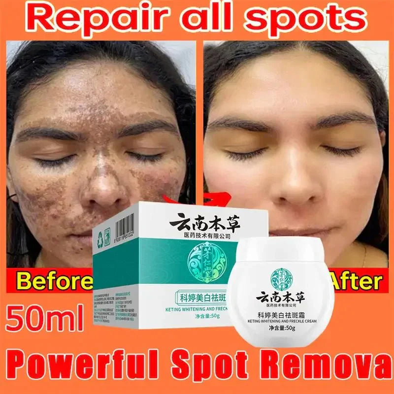 Dark Spot Corrector