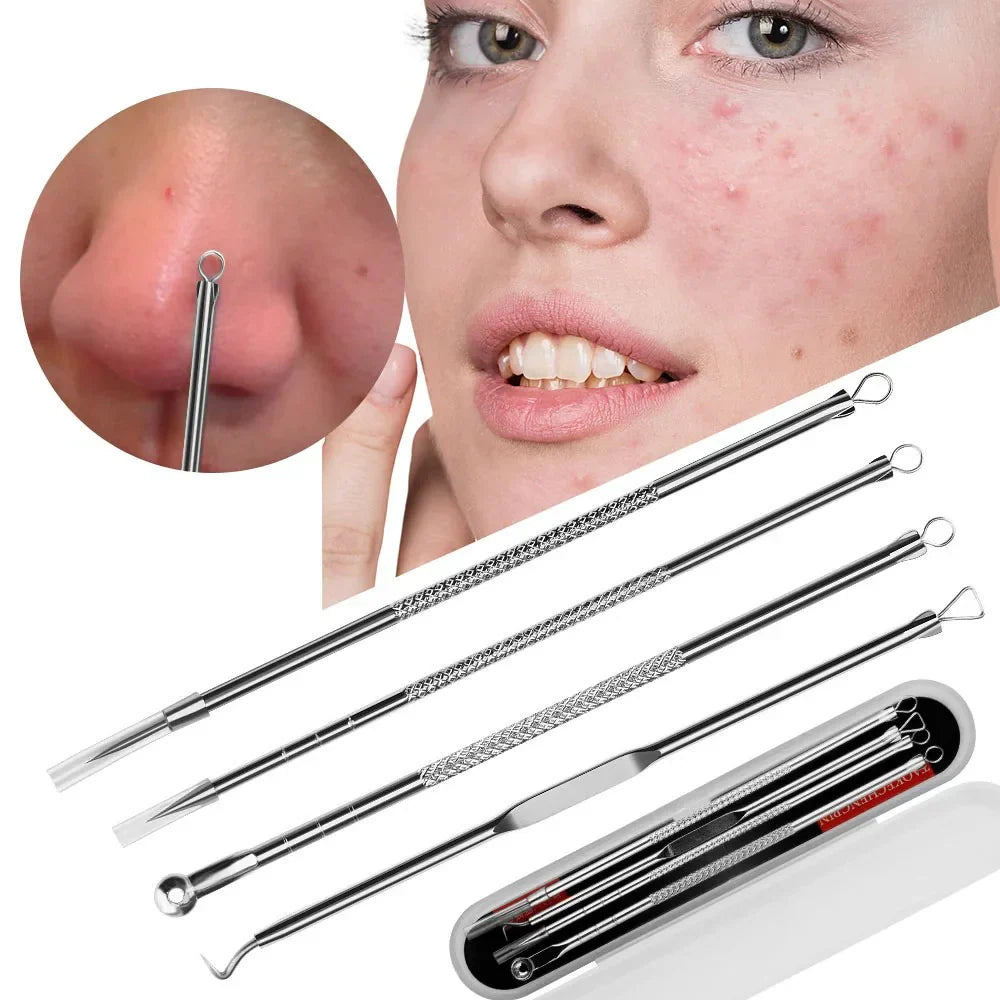 Acne Blackhead Removal Tool Kit